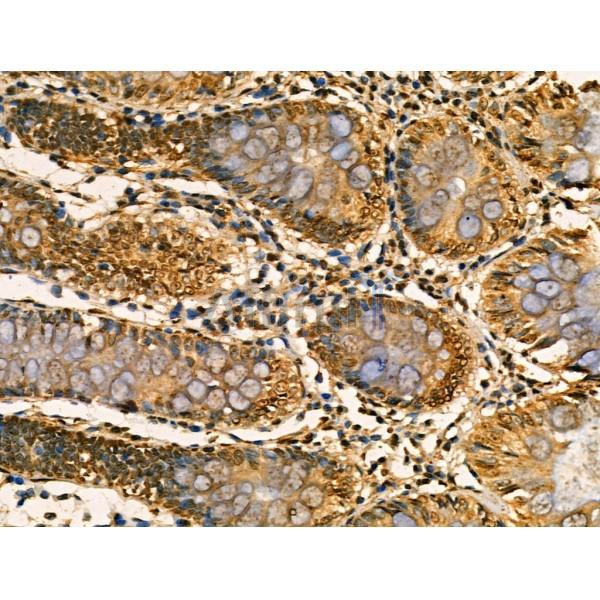 Phospho-SGK1 (Ser78) Antibody -AF3789