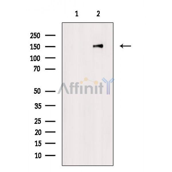 Phospho-Dnmt1 (Tyr399) Antibody -AF3790