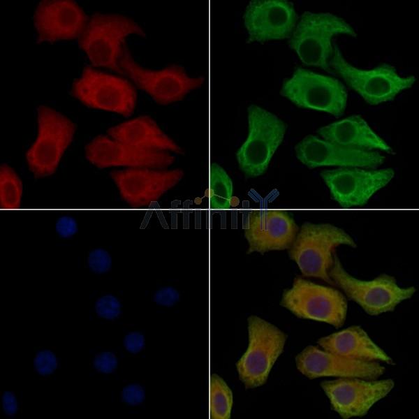 Phospho-IREB1 (Ser711) Antibody -AF3792