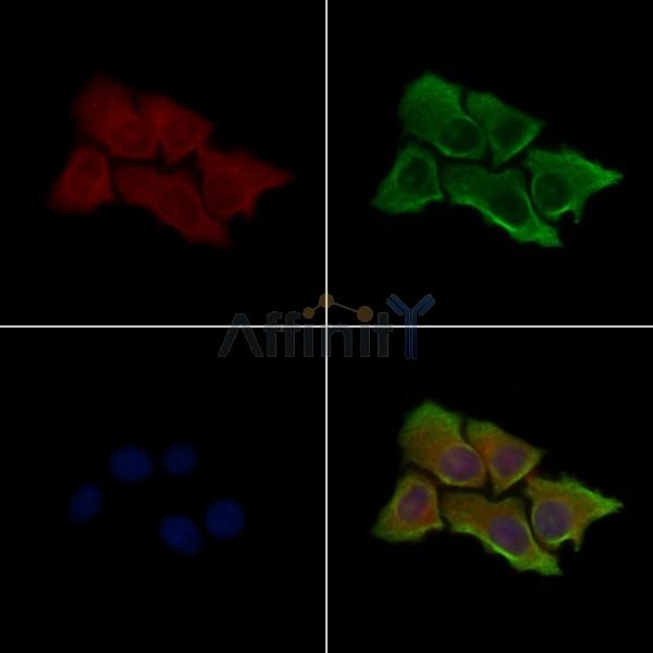 Phospho-CaMK2 alpha (Ser331) Antibody -AF3793