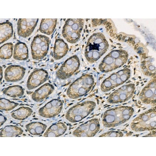 Acetyl-NF?B-p65 (Lys314/315) Antibody -AF3795