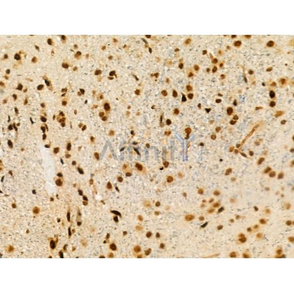 Phospho-MyoD1 (Ser200) Antibody -AF3799