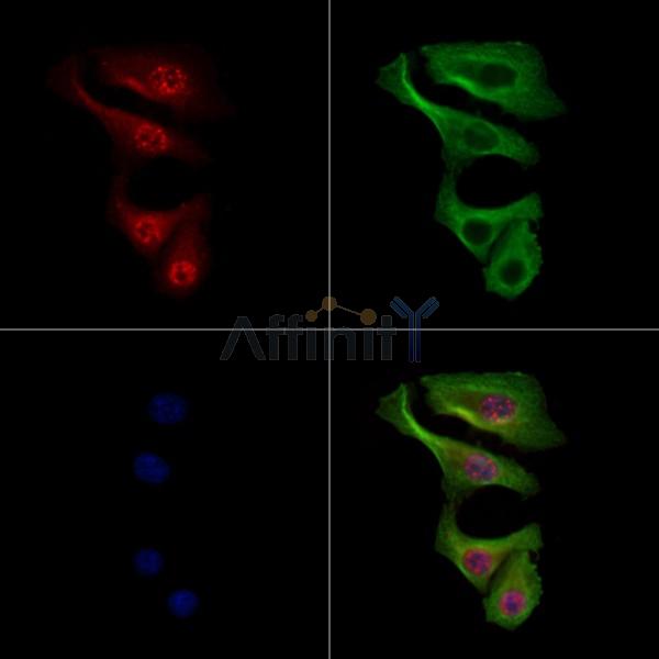 Phospho-MKK3/MKK6 (Thr193/Thr211) Antibody -AF3803