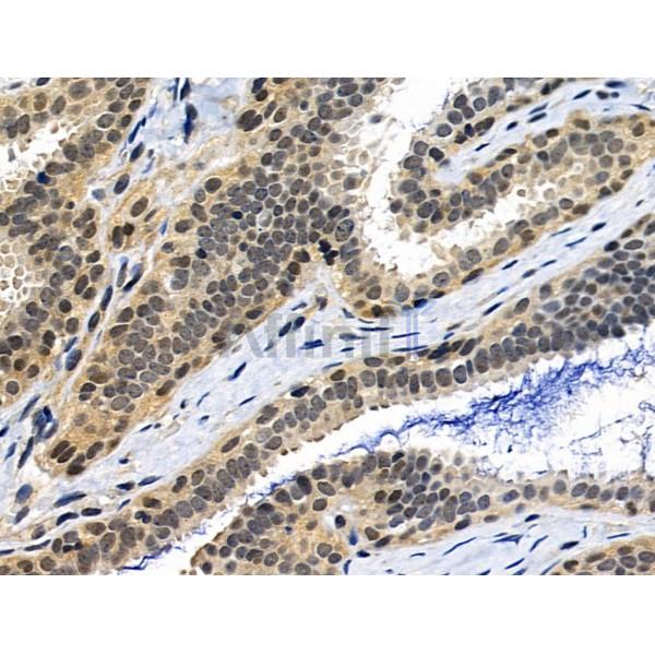 Phospho-MKK3/MKK6 (Ser189/Ser207) Antibody -AF3804