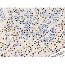Phospho-ARRB1 (Ser412) Antibody -AF3806