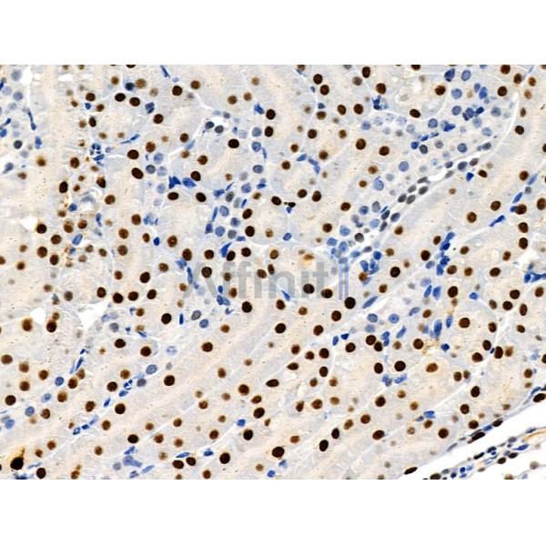 Phospho-ARRB1 (Ser412) Antibody -AF3806