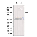 Phospho-IRS1 (Tyr989) Antibody -AF3807