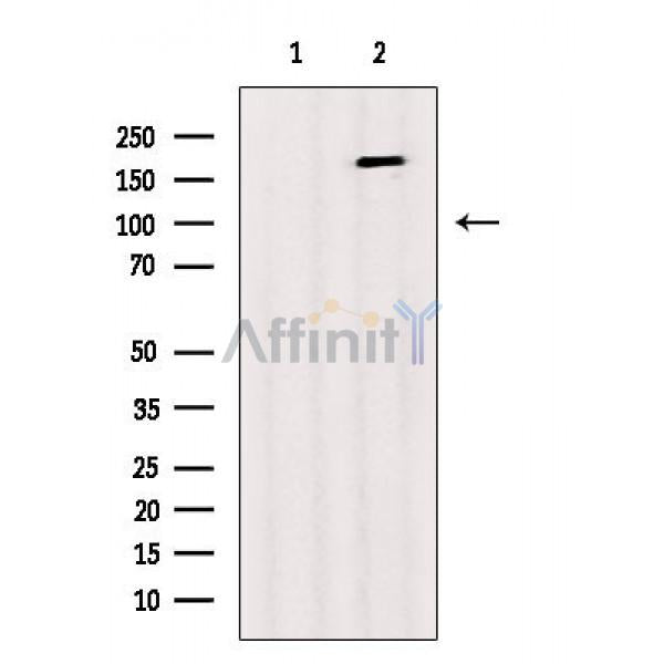 Phospho-IRS1 (Tyr989) Antibody -AF3807