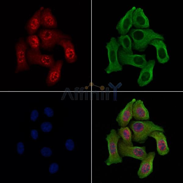 Phospho-WEE1 (Ser123) Antibody -AF3815