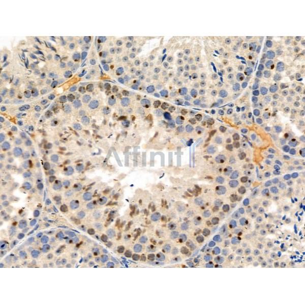 Phospho-53BP1 (Thr543) Antibody -AF3817
