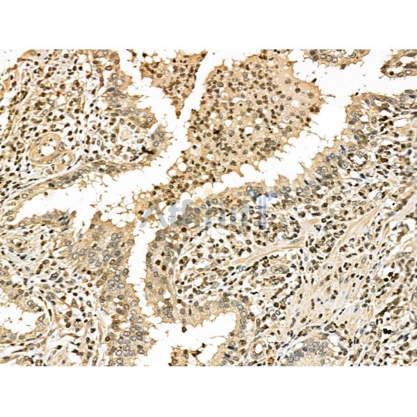 Phospho-53BP1 (Ser25/Ser29) Antibody -AF3818