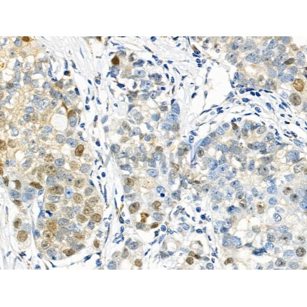 Phospho-p57 Kip2 (Thr310) Antibody -AF3819