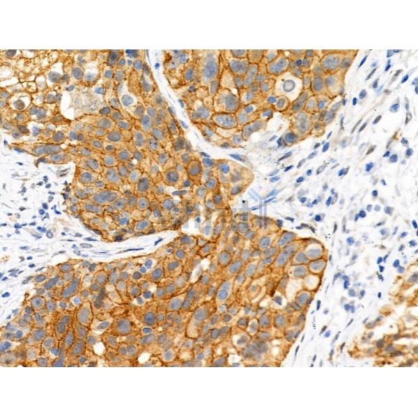 Phospho-alpha 1 Catenin (Ser655/Thr658) Antibody -AF3820
