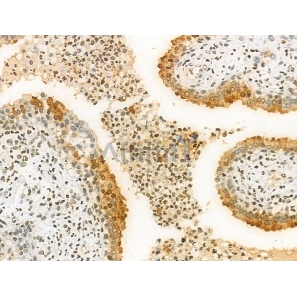 Acetyl-Histone H2A.X (Lys9) Antibody -AF3823
