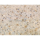 Phospho-Tau (Thr492/Thr175) Antibody -AF3825