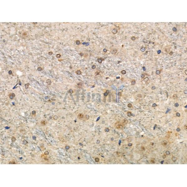 Phospho-Tau (Thr492/Thr175) Antibody -AF3825