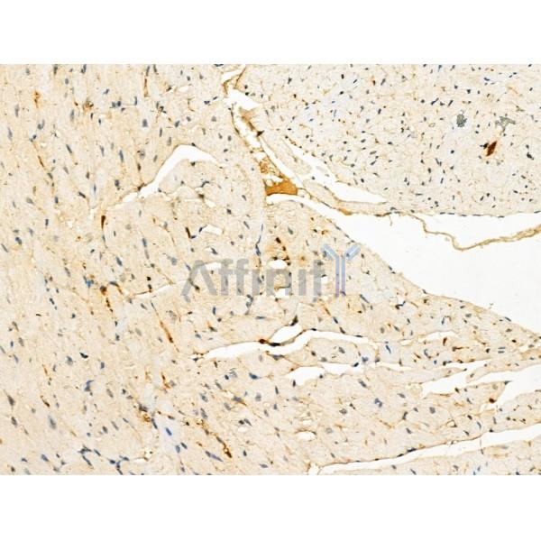 Phospho-BCKDHA (Ser292/Ser337) Antibody -AF3826