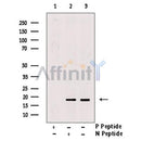 Phospho-4E-BP1 (Thr37/Thr46) Antibody -AF3830