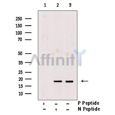 Phospho-4E-BP1 (Thr37/Thr46) Antibody -AF3830