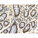 Phospho-TDP43 (Ser409/Ser410) Antibody -AF3832