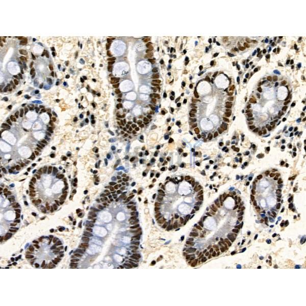 Phospho-TDP43 (Ser409/Ser410) Antibody -AF3832