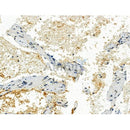Phospho-Perilipin-1 (Ser522) Antibody -AF3834