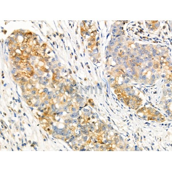 Phospho-FGFR2 (Tyr586/Tyr588) Antibody -AF3839