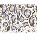 Phospho-AIRE (Ser156) Antibody -AF3841