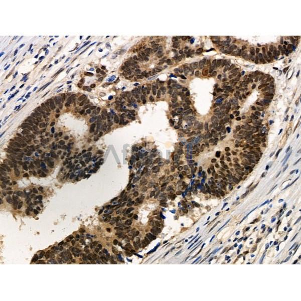 Phospho-Hsp90 alpha (Thr5/Thr7) Antibody -AF3842