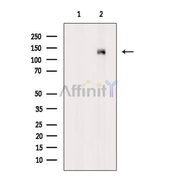 Phospho-PKD1/PKC mu (Ser910) Antibody -AF3843