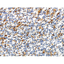 Phospho-ILK (Thr173) Antibody -AF3847