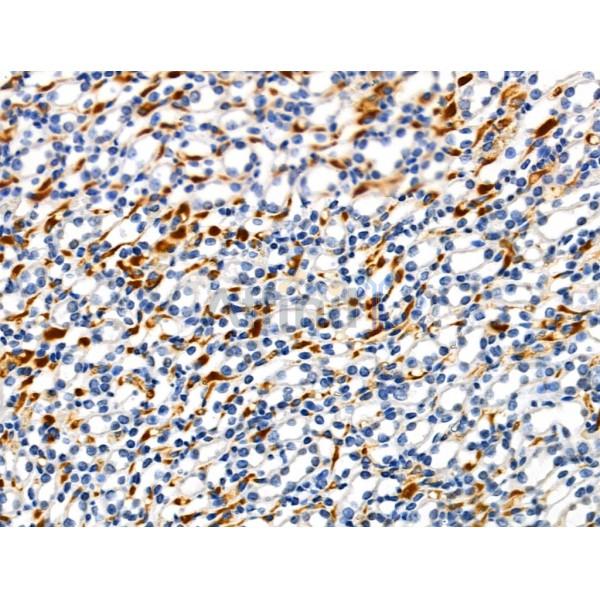 Phospho-ILK (Thr173) Antibody -AF3847
