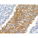 Phospho-ILK (Ser246) Antibody -AF3848