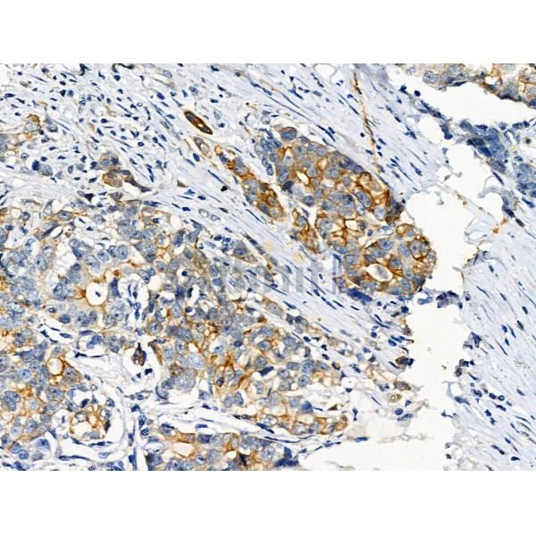 Phospho-Cytokeratin 18 (Ser51) Antibody -AF3849