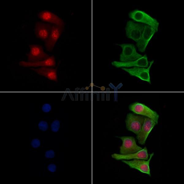 Phospho-Rpb1 CTD (Ser7) Antibody -AF3851
