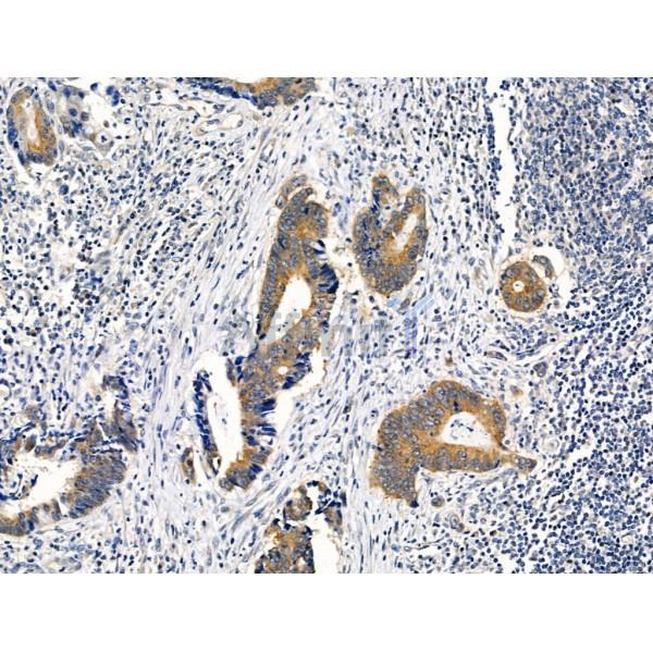 Phospho-TGFBR1 (Thr186) Antibody -AF3854
