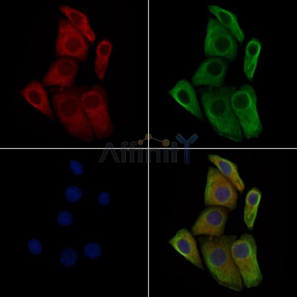 Phospho-TGFBR2 (Ser553) Antibody -AF3855