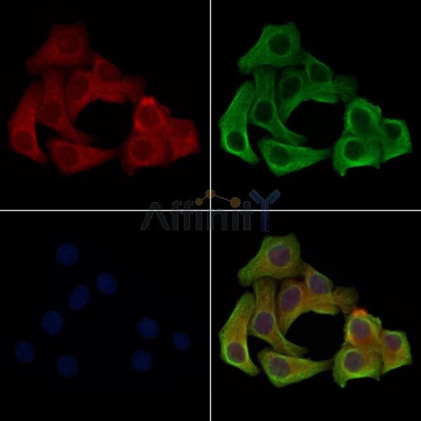 Phospho-LRP6 (Ser1420) Antibody -AF3857