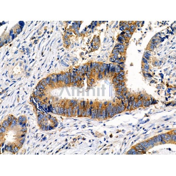Phospho-MKK7 (Thr275) Antibody -AF3859