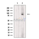Phospho-HGS (Tyr216) Antibody -AF3861