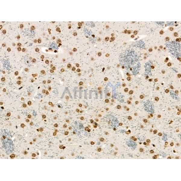Phospho-MKK4 (Ser257/Thr261) Antibody -AF3862
