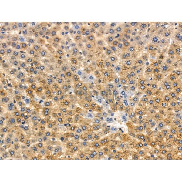 Phospho-PYGL (Ser17) Antibody -AF3863