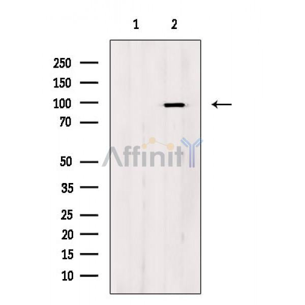 Phospho-HMGCR (Ser872) Antibody -AF3865