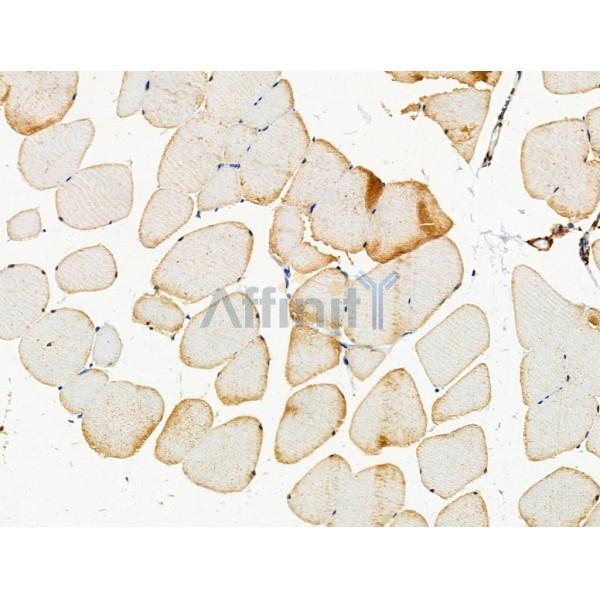 Phospho-PKD1/PKC mu (Ser205) Antibody -AF3867
