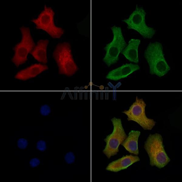 Phospho-MLC2 (Tyr118) Antibody -AF3869