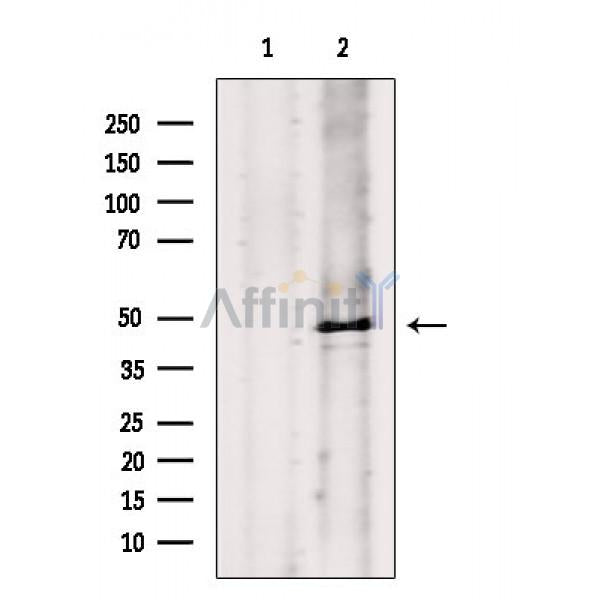 Phospho-Caspase 9 (Ser196) Antibody -AF3870