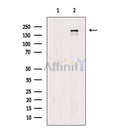 Phospho-Integrin beta 4 (Thr1530) Antibody -AF3872