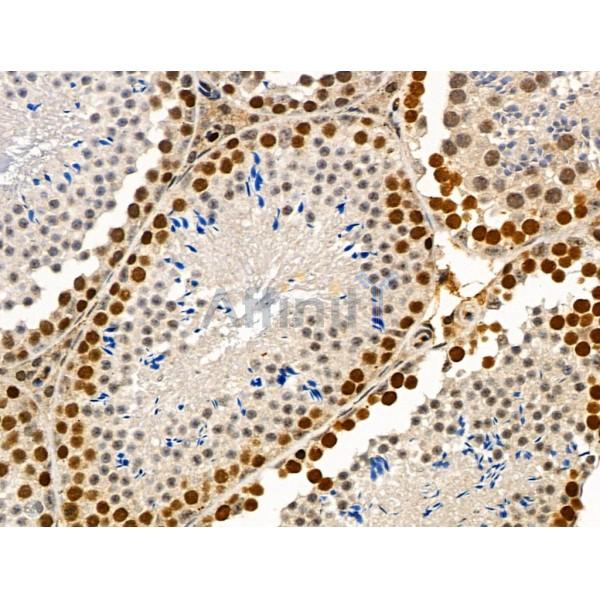 Phospho-SMC1 (Ser966) Antibody -AF3876