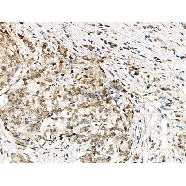 Phospho-SMC1 (Ser957) Antibody -AF3878