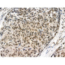 Phospho-n-Myc (Ser261/Ser263) Antibody -AF3881